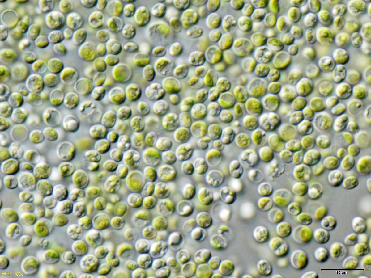Chlorella vulgaris under a microscope